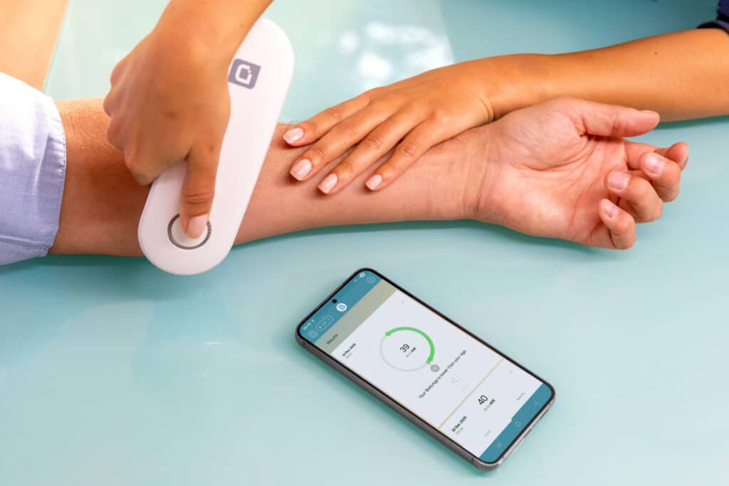 Diagnoptics AGE Scanner In Use 028   BodyAge App (1)