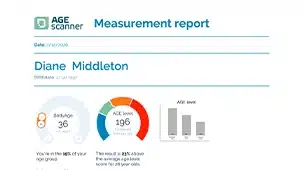 AGE Scanner report highlighting body age and age level with diagram for health insights