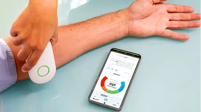 AGE Scanner testing a hand with real-time age results displayed on mobile for lifestyle monitoring
